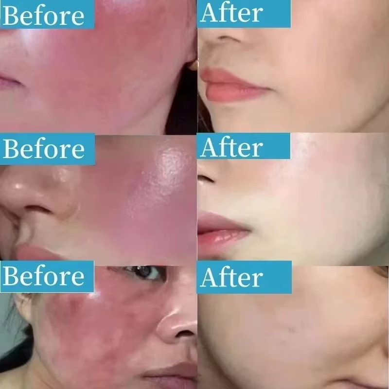 Crema Coreana Riparatrice per  - Coenzyme Q10 Cream recensione e prezzo
