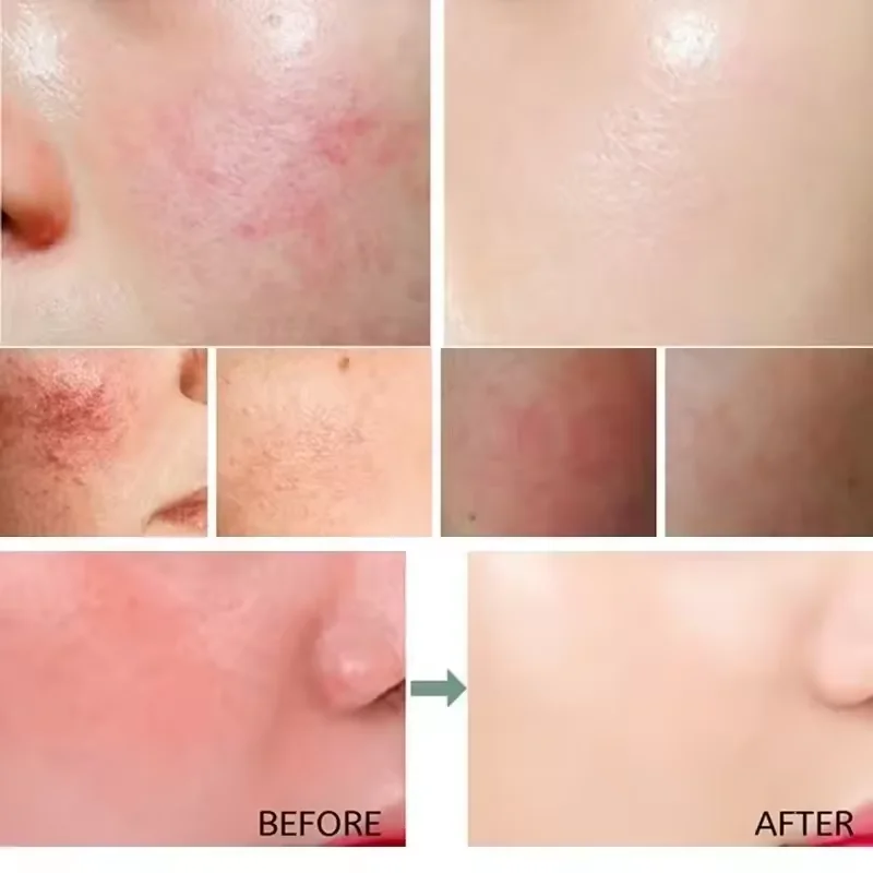 Crema riparatrice per il rosso - Coenzyme Q10 Cream recensione e prezzo