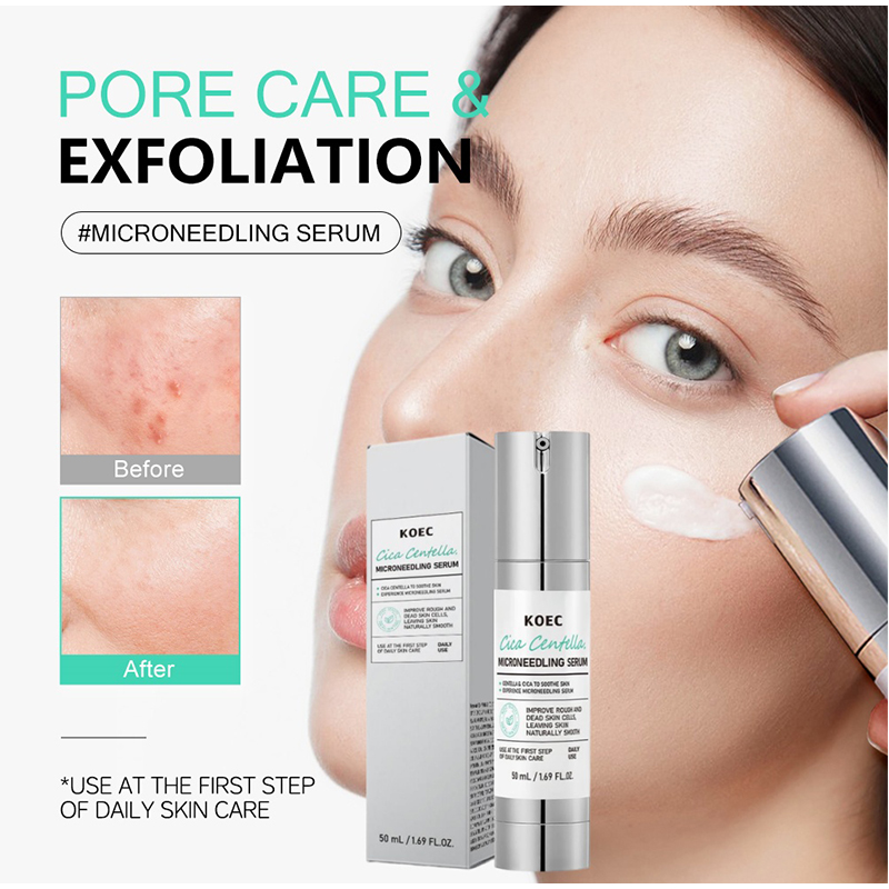 Siero Microneedling Spicule, E - Centella Asiatica Toner recensione e prezzo